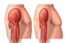sarcopenia diagnosi differenza tra muscoli